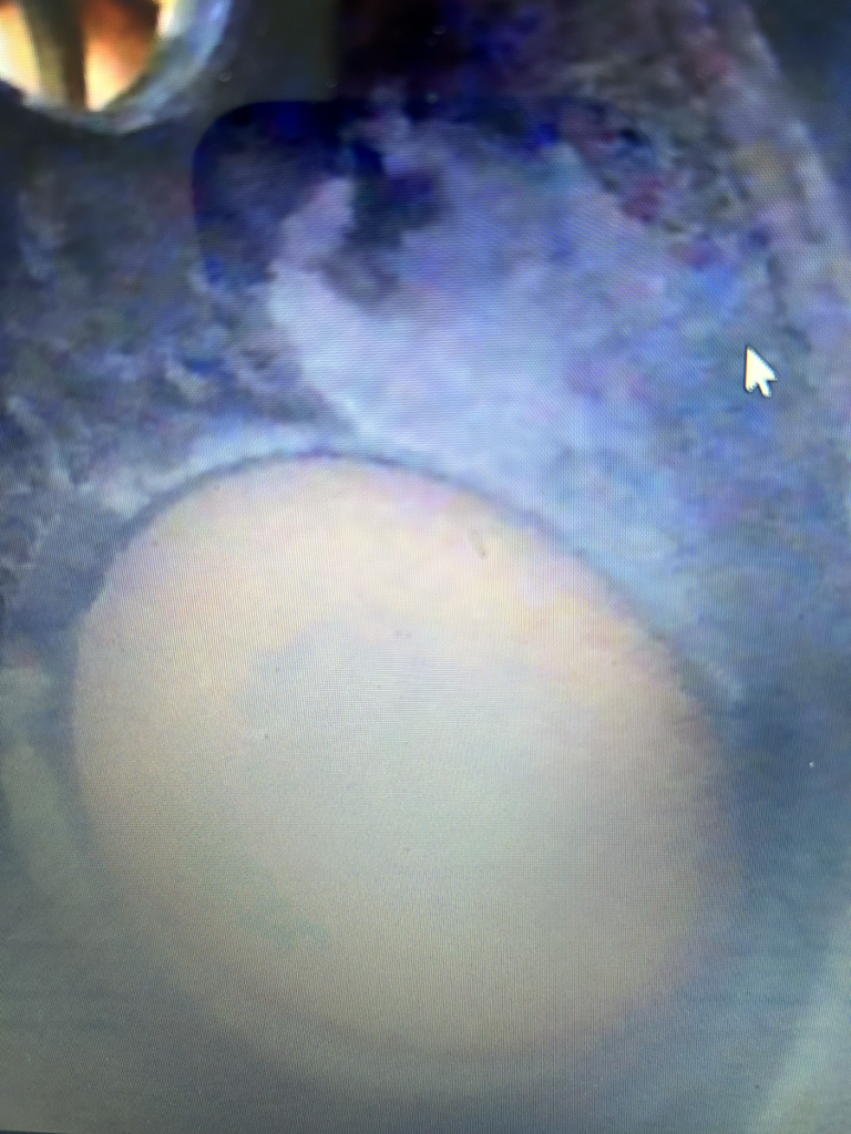 N2018M - borescope 02